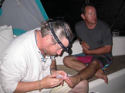 Bradley performs surgery on Dave's toe