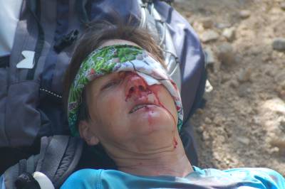 Face cuts cause lots of blood - yuc!