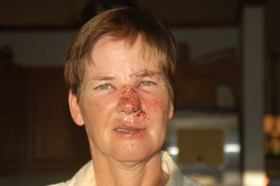 After the doctor was done with me